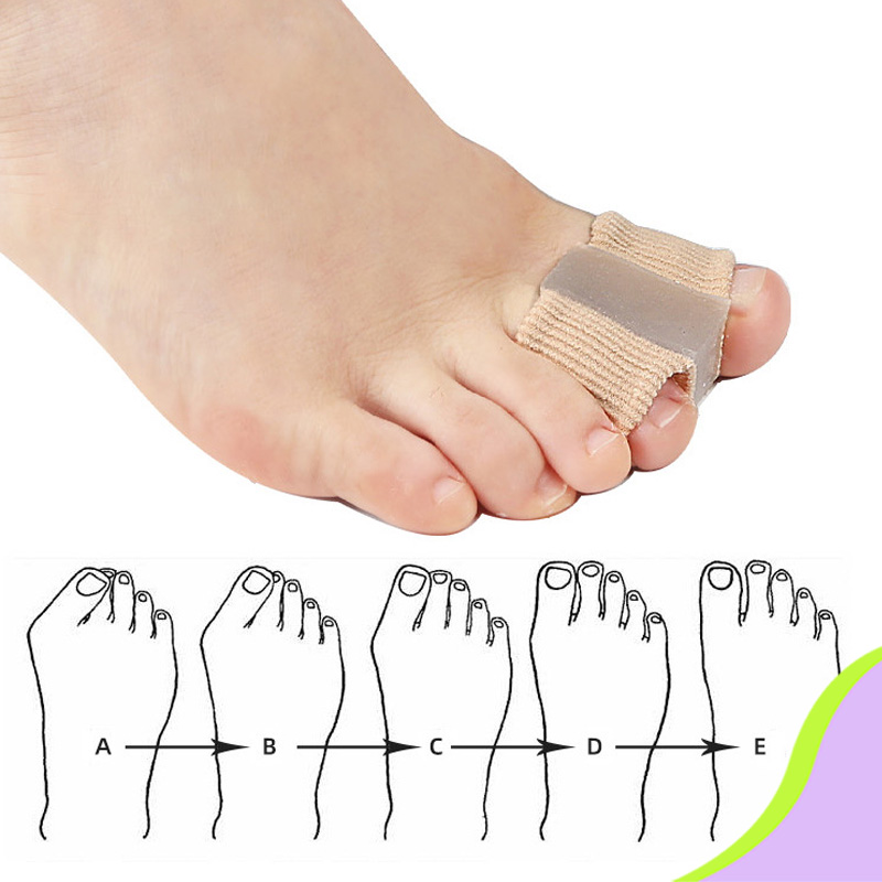  Toe Separators